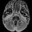 brain2.bmp